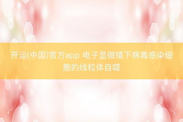开运(中国)官方app 电子显微镜下病毒感染细胞的线粒体自噬